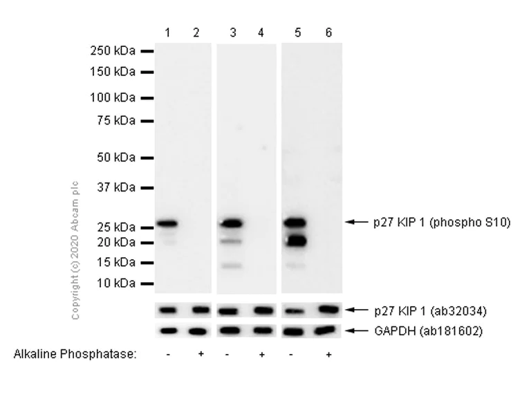 Western blot - Anti-p27 KIP 1 (phospho S10) antibody [EP233(2)Y] - BSA and Azide free (AB228877)