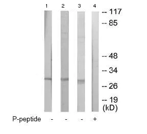 Western blot - Anti-p27 KIP 1 (phospho T198) antibody (AB64949)