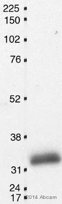 Western blot - Anti-p27 KIP 1 (phospho T198) antibody (AB64949)