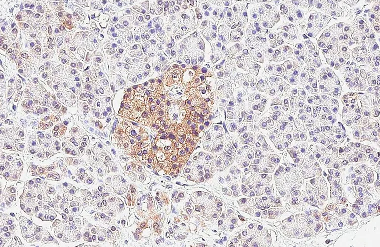 Immunohistochemistry (Formalin/PFA-fixed paraffin-embedded sections) - Anti-P2RY1 antibody [HL2702] - BSA and Azide free (AB325869)