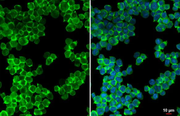 Immunocytochemistry/ Immunofluorescence - Anti-P2RY2 antibody [HL2704] - BSA and Azide free (AB325870)