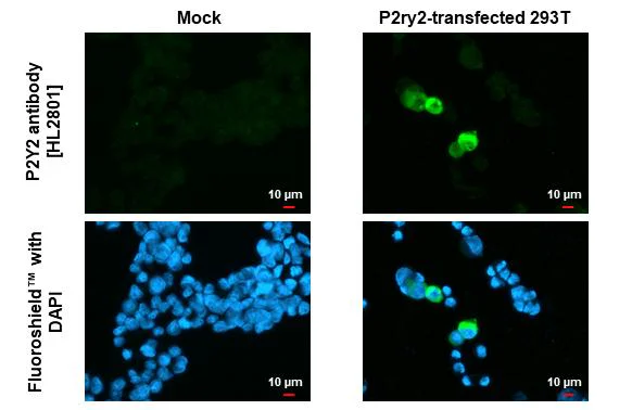 Immunocytochemistry/ Immunofluorescence - Anti-P2ry2 antibody [HL2801] - BSA and Azide free (AB325871)