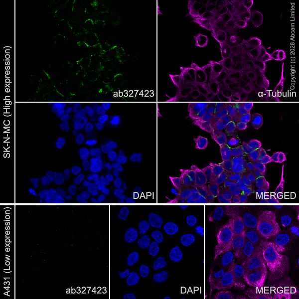 Immunocytochemistry/ Immunofluorescence - Anti-P2X2 antibody [EPR25193-215] (AB327423)