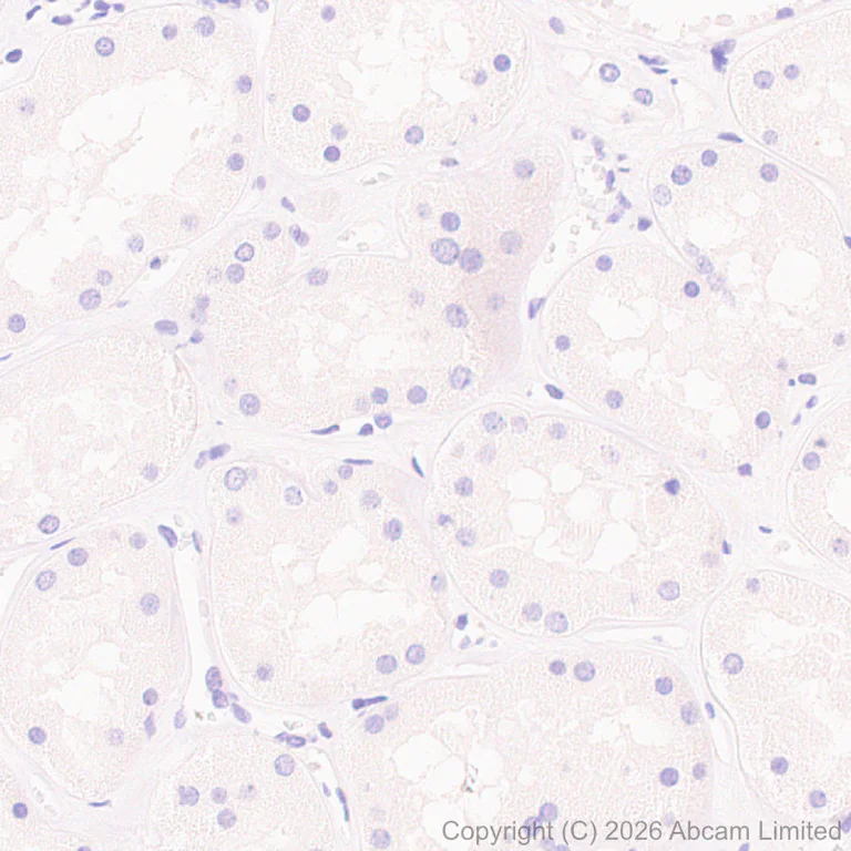 Immunohistochemistry (Formalin/PFA-fixed paraffin-embedded sections) - Anti-P2X2 antibody [EPR25193-215] (AB327423)