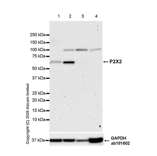 Western blot - Anti-P2X2 antibody [EPR25193-215] (AB327423)