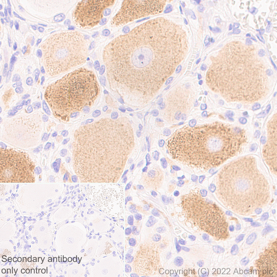 Immunohistochemistry (Formalin/PFA-fixed paraffin-embedded sections) - Anti-P2X3 antibody [EPR26568-3] (AB300493)