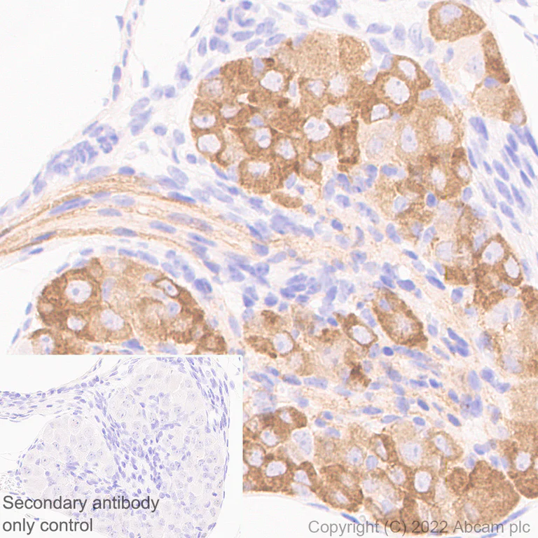 Immunohistochemistry (Formalin/PFA-fixed paraffin-embedded sections) - Anti-P2X3 antibody [EPR26568-3] (AB300493)