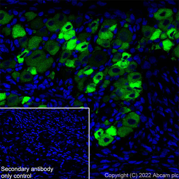 Immunohistochemistry (Frozen sections) - Anti-P2X3 antibody [EPR26568-3] (AB300493)
