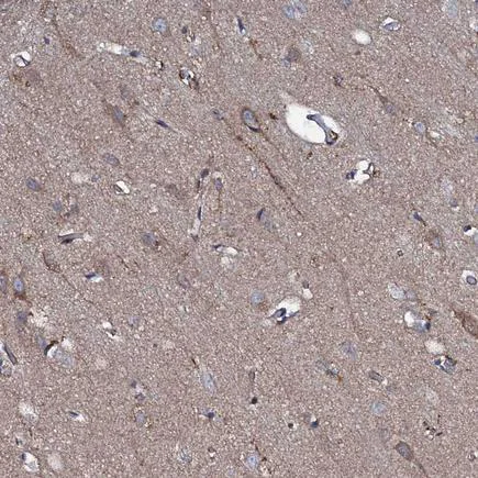 Immunohistochemistry (Formalin/PFA-fixed paraffin-embedded sections) - Anti-P2X4 antibody (AB243734)