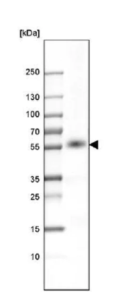 Western blot - Anti-P2X4 antibody (AB243734)