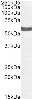 Western blot - Anti-P2X4 antibody (AB77434), expandable thumbnail