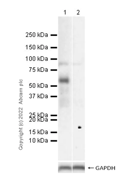 Western blot - Anti-P2X4 antibody [EPR25194-152] (AB303496)