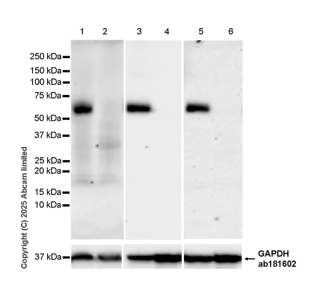 Western blot - Anti-P2X4 antibody [EPR29153-16] (AB324165)
