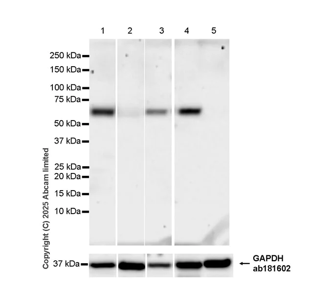 Western blot - Anti-P2X4 antibody [EPR29153-16] (AB324165)
