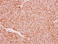 Immunohistochemistry (Formalin/PFA-fixed paraffin-embedded sections) - Anti-P2X5 antibody (AB126206)