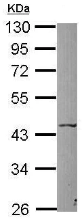 Western blot - Anti-P2X5 antibody (AB126206)