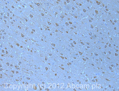 Immunohistochemistry (Formalin/PFA-fixed paraffin-embedded sections) - Anti-P2X7 antibody (AB109054), expandable thumbnail