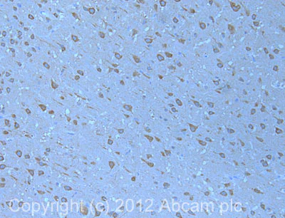 Immunohistochemistry (Formalin/PFA-fixed paraffin-embedded sections) - Anti-P2X7 antibody (AB109054)