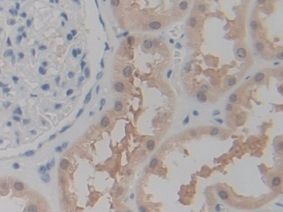 Immunohistochemistry (Formalin/PFA-fixed paraffin-embedded sections) - Anti-P2X7 antibody (AB233527)