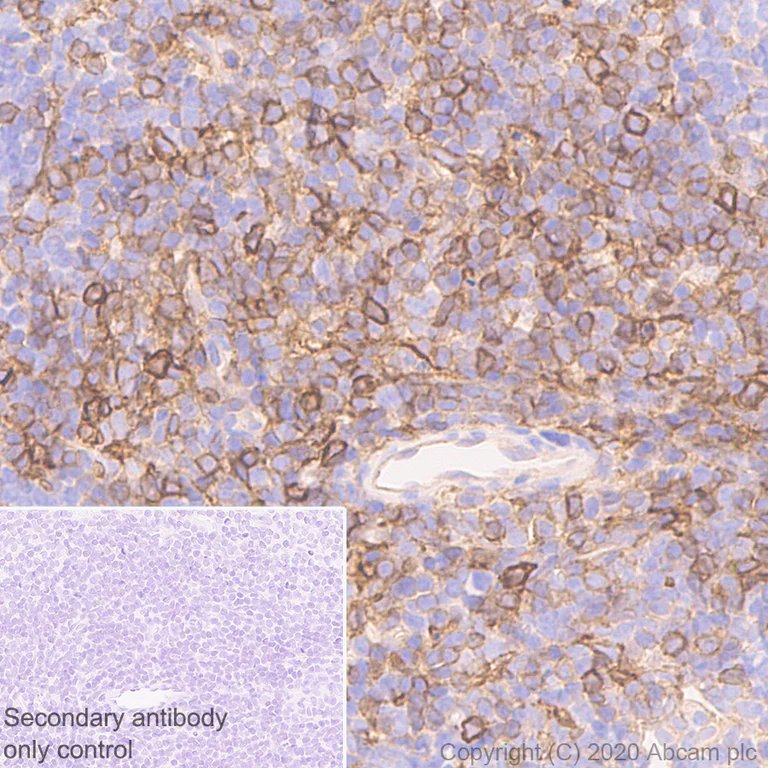 Immunohistochemistry (Formalin/PFA-fixed paraffin-embedded sections) - Anti-P2X7 antibody [EPR24130-77] (AB259942)