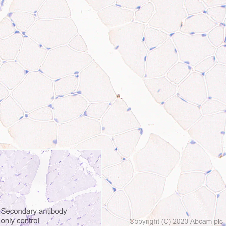 Immunohistochemistry (Formalin/PFA-fixed paraffin-embedded sections) - Anti-P2X7 antibody [EPR24130-77] - BSA and Azide free (AB279709)