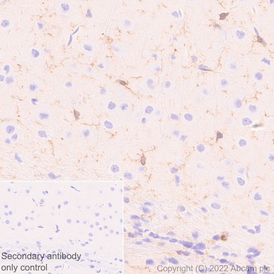 Immunohistochemistry (Formalin/PFA-fixed paraffin-embedded sections) - Anti-P2X7 antibody [EPR26989-11] (AB307718), expandable thumbnail