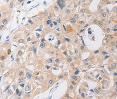 Immunohistochemistry (Formalin/PFA-fixed paraffin-embedded sections) - Anti-P2Y11 antibody (AB180739)
