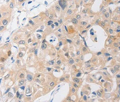 Immunohistochemistry (Formalin/PFA-fixed paraffin-embedded sections) - Anti-P2Y11 antibody (AB180739)