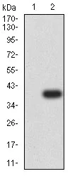 Western blot - Anti-P2Y12 antibody [1C2A9] (AB233760)