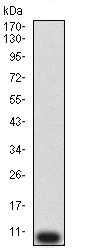 Western blot - Anti-P2Y12 antibody [1C2A9] (AB233760)