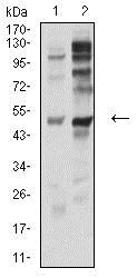 Western blot - Anti-P2Y12 antibody [1C2A9] (AB233760)