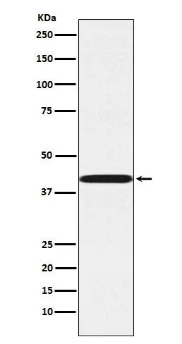 Western blot - Anti-P2Y12 antibody [43E7] (AB326698)