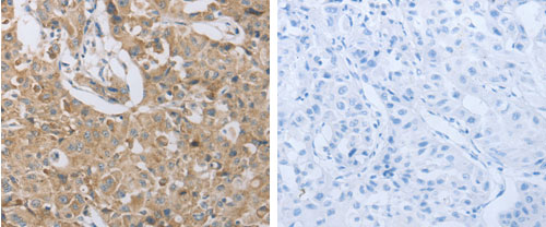 Immunohistochemistry (Formalin/PFA-fixed paraffin-embedded sections) - Anti-P2Y12 antibody (AB183066), expandable thumbnail