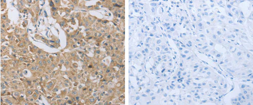 Immunohistochemistry (Formalin/PFA-fixed paraffin-embedded sections) - Anti-P2Y12 antibody (AB183066)