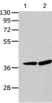 Western blot - Anti-P2Y12 antibody (AB183066)