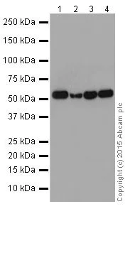 Western blot - Anti-P2Y12 antibody [EPR18611] (AB184411)