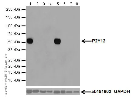 Western blot - Anti-P2Y12 antibody [EPR18611] (AB184411)