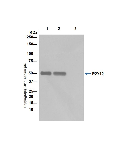 Immunoprecipitation - Anti-P2Y12 antibody [EPR18611] - BSA and Azide free (AB240285), expandable thumbnail
