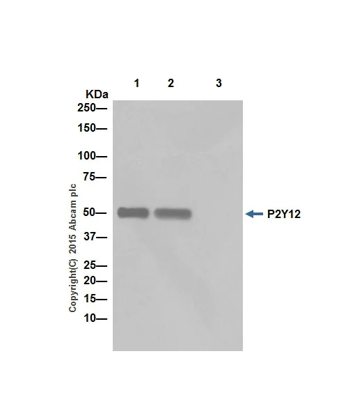 Immunoprecipitation - Anti-P2Y12 antibody [EPR18611] - BSA and Azide free (AB240285)