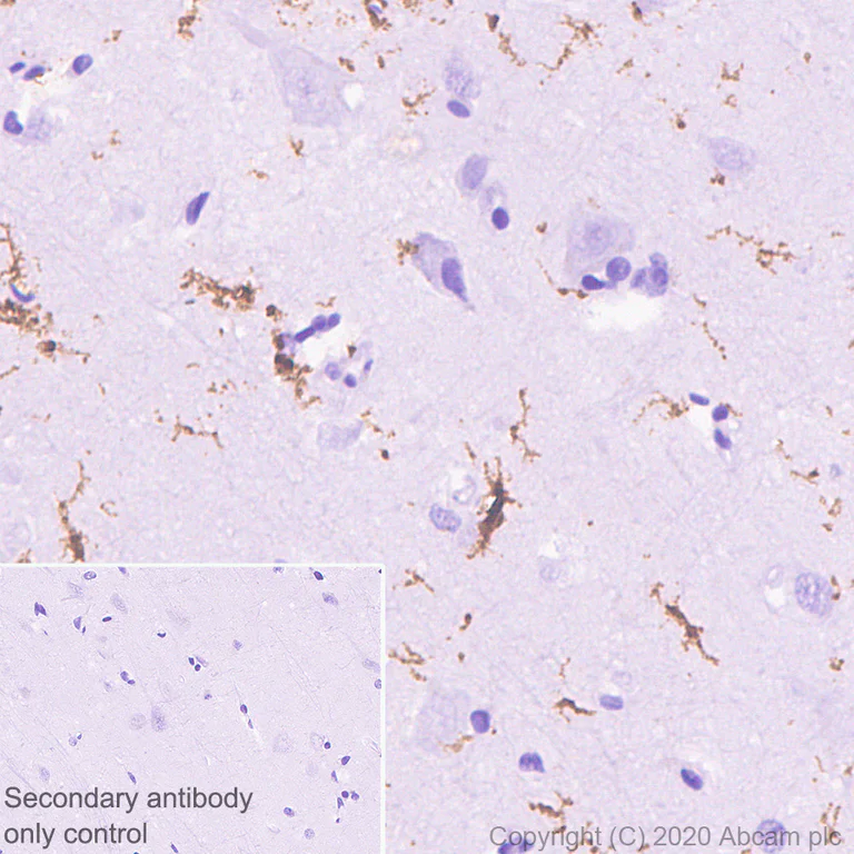 Immunohistochemistry (Formalin/PFA-fixed paraffin-embedded sections) - Anti-P2Y12 antibody [EPR23511-72] (AB254347)
