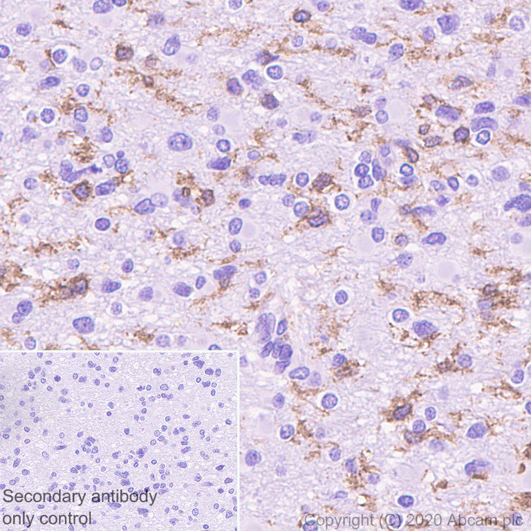 Immunohistochemistry (Formalin/PFA-fixed paraffin-embedded sections) - Anti-P2Y12 antibody [EPR23511-72] (AB254347)