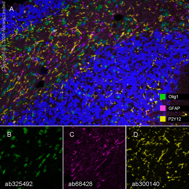 Multiplex immunohistochemistry - Anti-P2Y12 antibody [EPR26298-93] (AB300140)