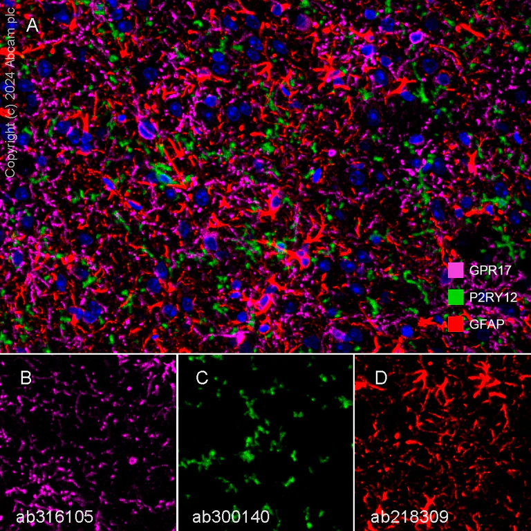 Multiplex immunohistochemistry - Anti-P2Y12 antibody [EPR26298-93] - BSA and Azide free (AB300141)