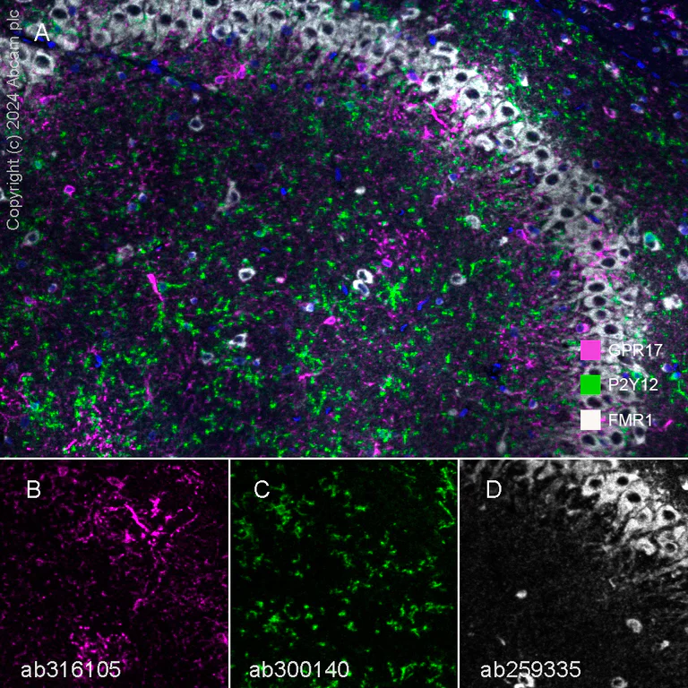 Multiplex immunohistochemistry - Anti-P2Y12 antibody [EPR26298-93] - BSA and Azide free (AB300141)