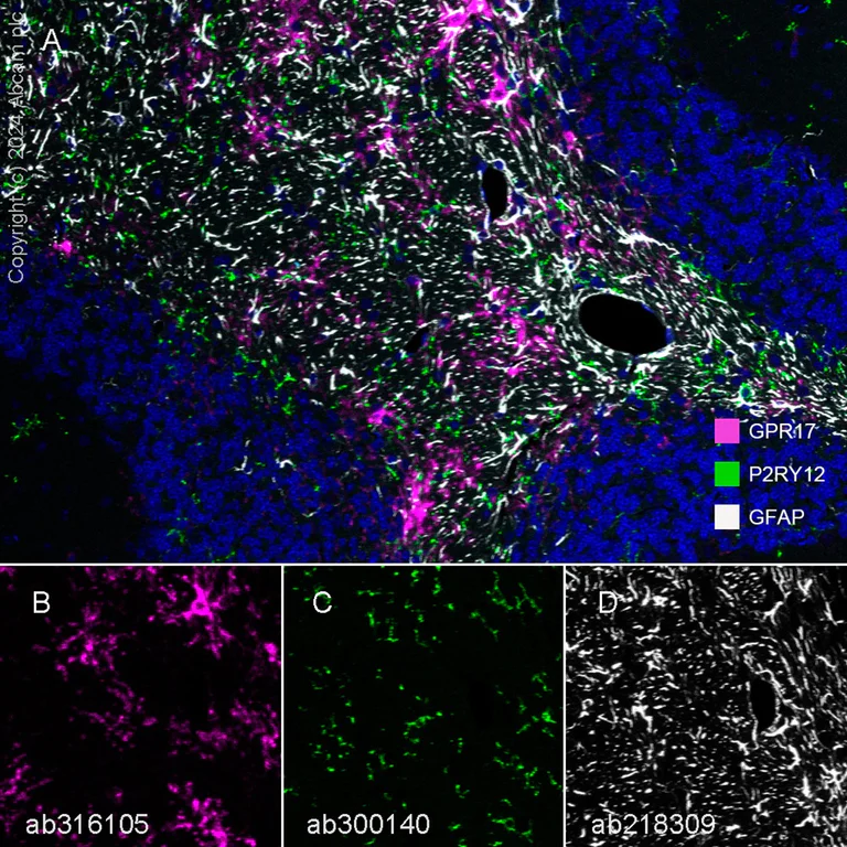 Multiplex immunohistochemistry - Anti-P2Y12 antibody [EPR26298-93] - BSA and Azide free (AB300141)
