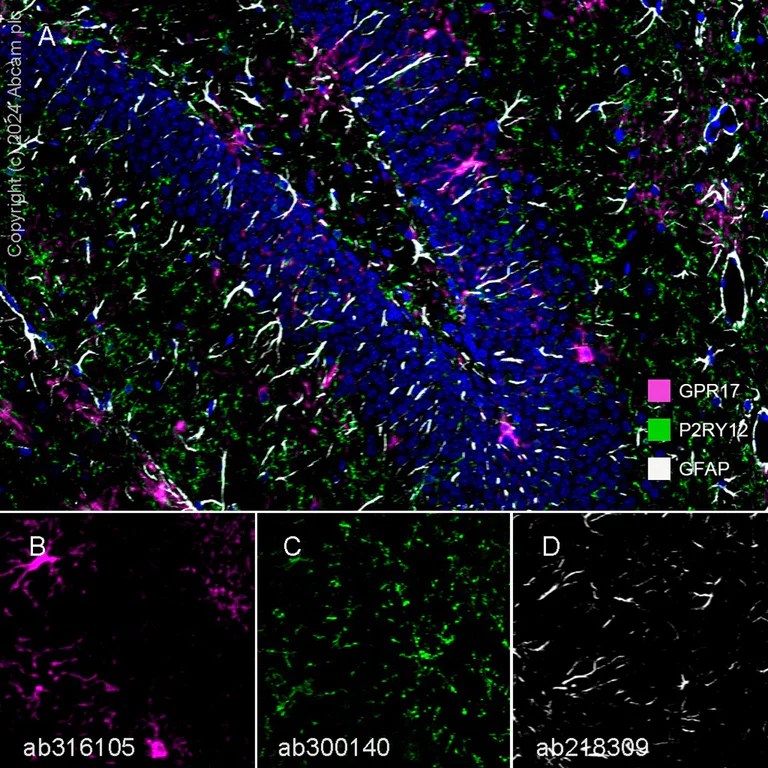 Multiplex immunohistochemistry - Anti-P2Y12 antibody [EPR26298-93] - BSA and Azide free (AB300141)