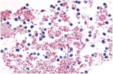 Immunohistochemistry (Formalin/PFA-fixed paraffin-embedded sections) - Anti-P2Y12 antibody - N-terminal (AB140862)