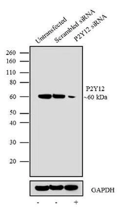 Western blot - Anti-P2Y12 antibody [RP23040204] (AB308032)