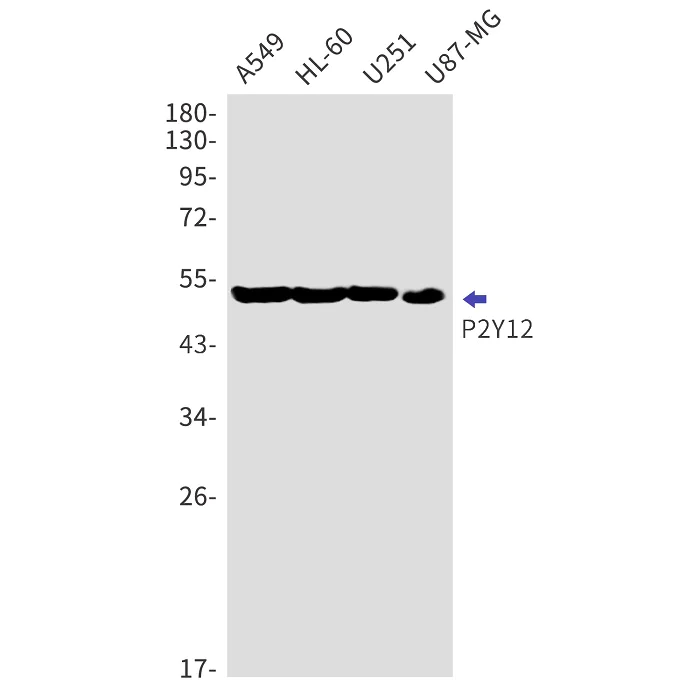 Western blot - Anti-P2Y12 Antibody [S02-2E1] (AB317430)