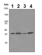 Western blot - Anti-P2Y13 antibody [EPR3698] (AB108444), expandable thumbnail
